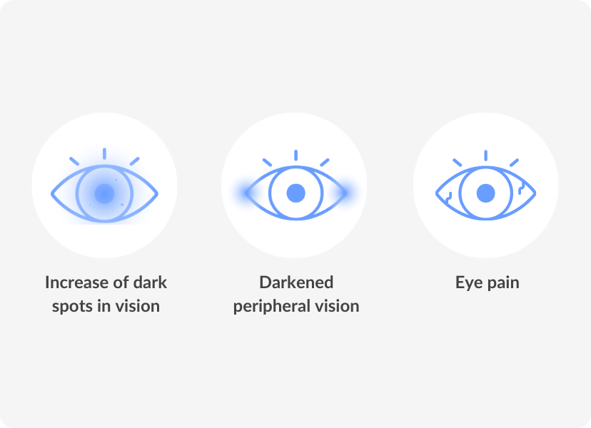 What Are Eye Floaters? | Black Spots In Vision | SmartBuyGlasses CA